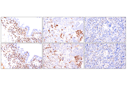 Immunohistochemistry Image 7: RUNX3/AML2 (E8D5W) XP<sup>®</sup> Rabbit mAb