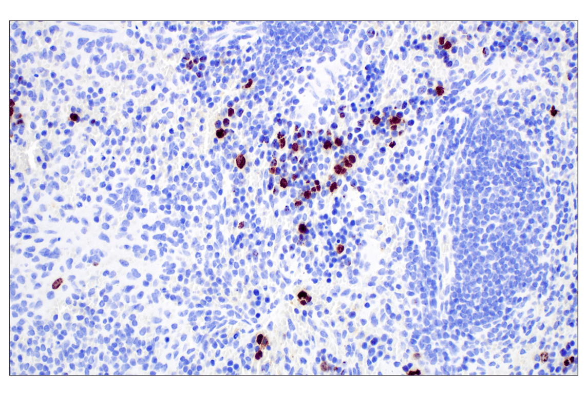 Immunohistochemistry Image 12: Phospho-Histone H3 (Ser10) (D7N8E) Rabbit Monoclonal Antibody (BSA and Azide Free)