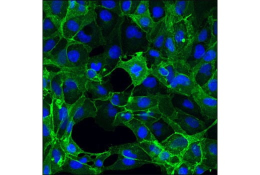 Immunofluorescence Image 1: Fas (4C3) Mouse Monoclonal Antibody
