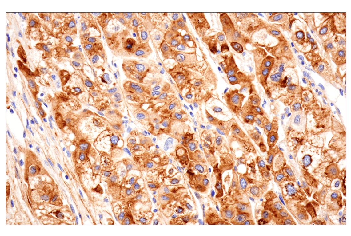 Immunohistochemistry Image 4: Vitronectin (F8D3L) Rabbit Monoclonal Antibody