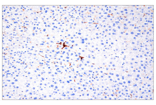 Immunohistochemistry Image 2: CD86 (E5W6H) Rabbit Monoclonal Antibody (BSA and Azide Free)