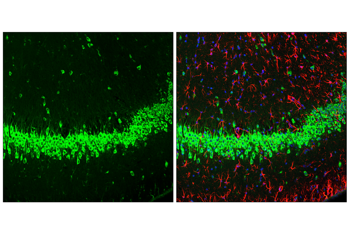 Immunofluorescence Image 3: YTHDF3 (E2J9I) Rabbit Monoclonal Antibody