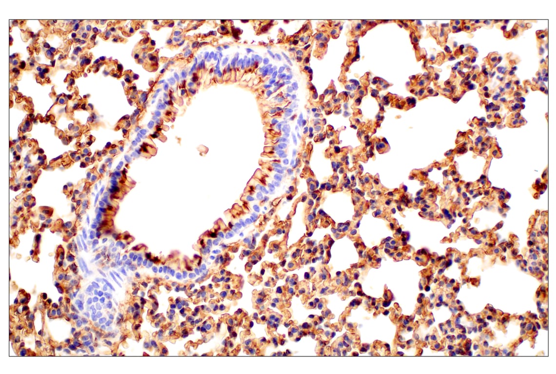 Immunohistochemistry Image 5: CD47 (E2V9V) Rabbit Monoclonal Antibody (BSA and Azide Free)