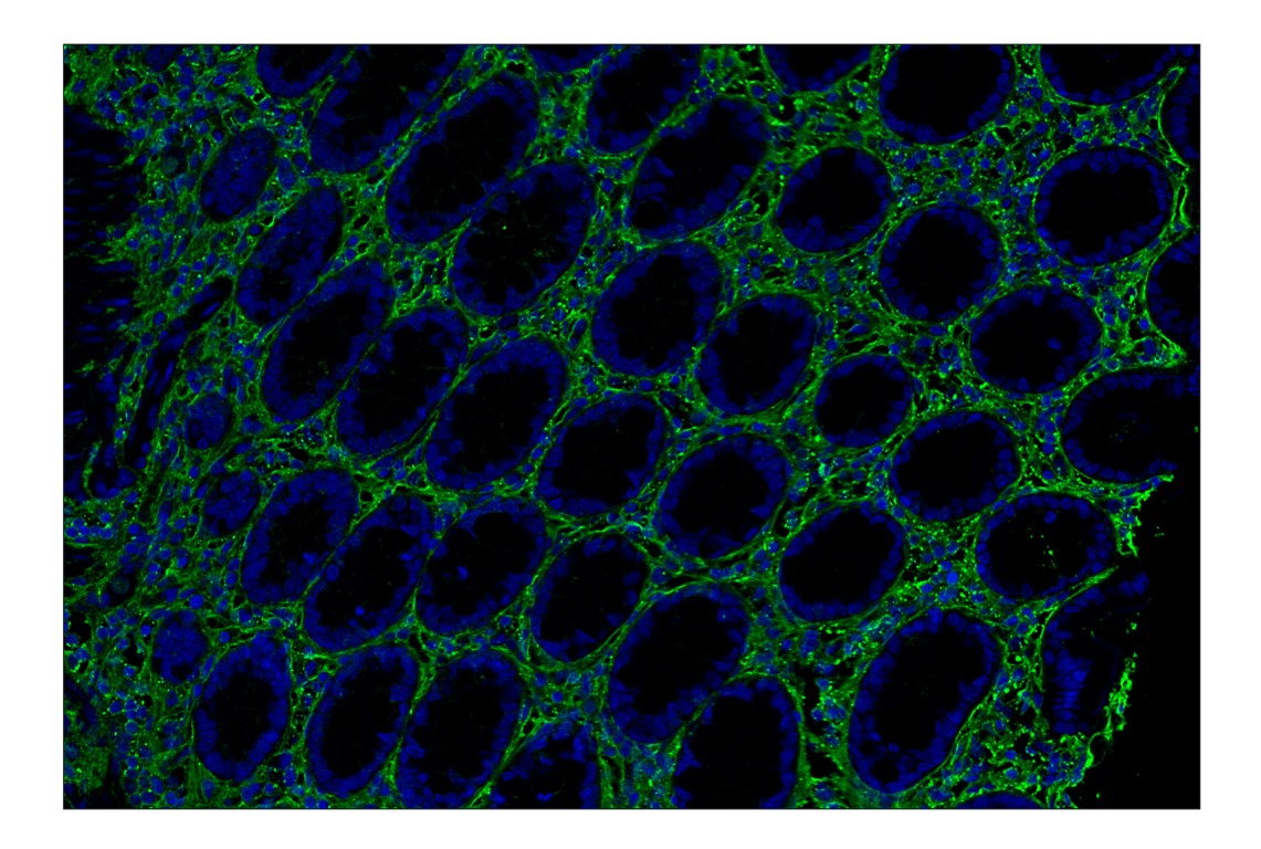 Immunohistochemistry Image 8: Hyaluronan Complete Tissue Staining Kit (Alexa Fluor<sup>®</sup> 488)
