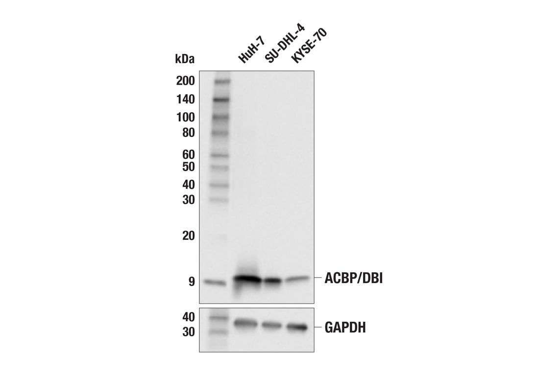 Western Blotting Image 1: ACBP/DBI (E6K8G) XP<sup>®</sup> Rabbit mAb