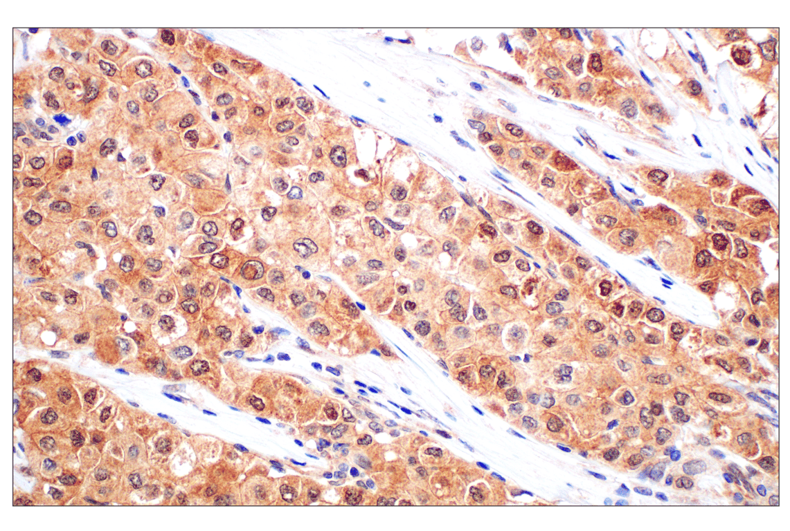 Immunohistochemistry Image 3: Stat3 (124H6) Mouse Monoclonal Antibody (BSA and Azide Free)