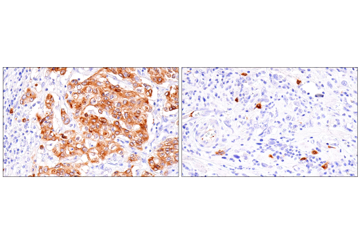 Immunohistochemistry Image 2: Rab27B (E4V3O) Rabbit Monoclonal Antibody