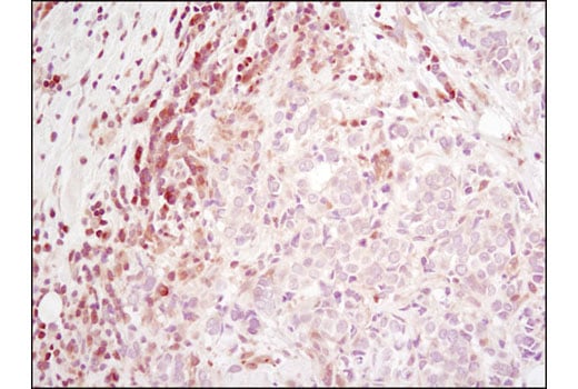 Immunohistochemistry Image 1: RSK2 (D21B2) Rabbit Monoclonal Antibody (BSA and Azide Free)