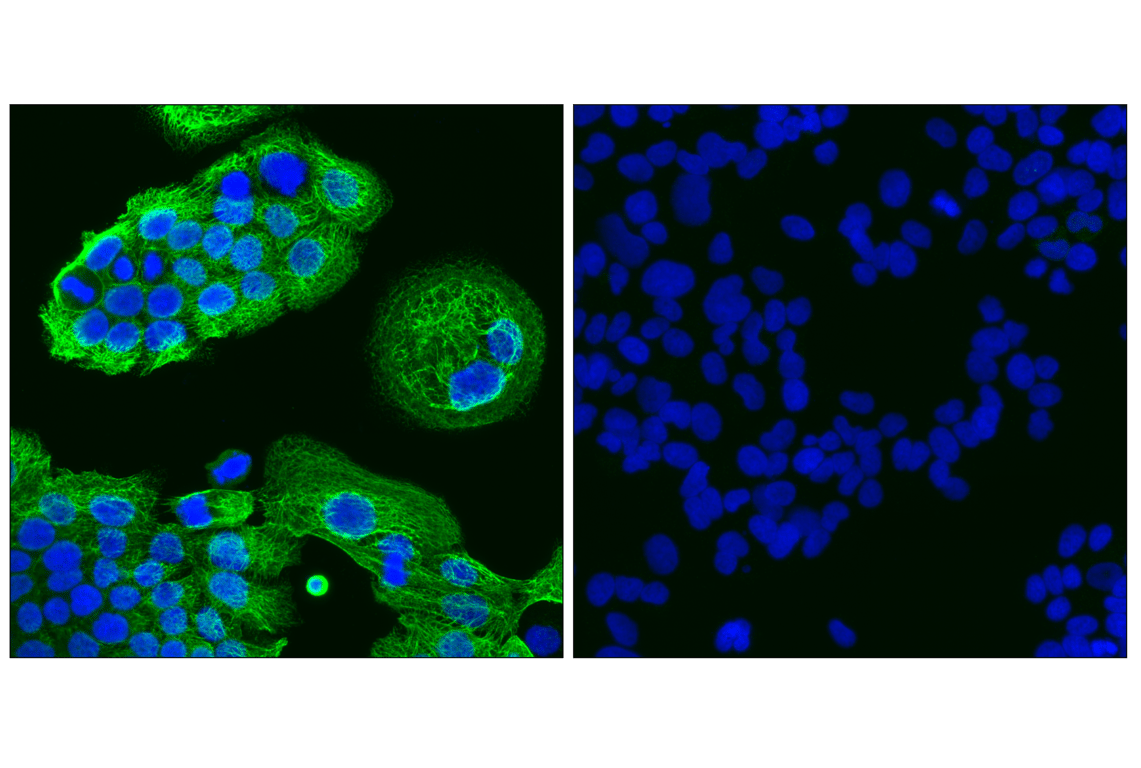 Immunofluorescence Image 1: Keratin 14 (LL002) Mouse Monoclonal Antibody