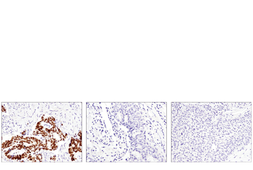 Immunohistochemistry Image 1: SATB2 (E8R8H) Rabbit Monoclonal Antibody