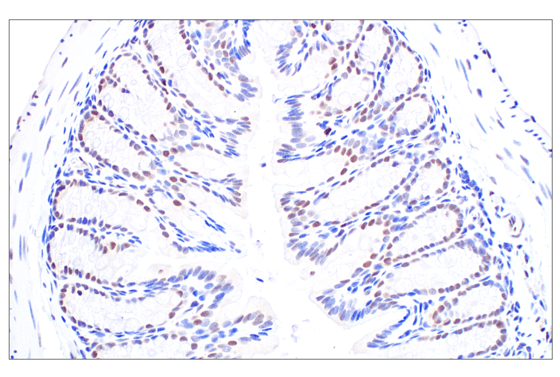 undefined Image 33: PPAR gamma Regulated Fatty Acid Metabolism Antibody Sampler Kit