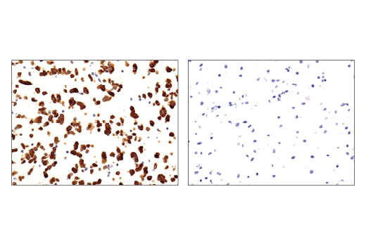 Immunohistochemistry Image 2: CRMP-2 (D8L6V) Rabbit Monoclonal Antibody