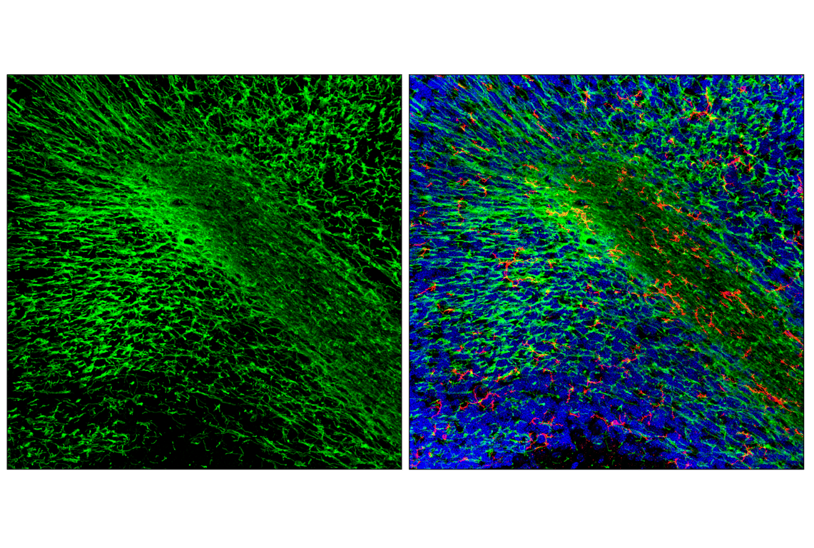 Immunofluorescence Image 3: CNPase (F6Y2X) Mouse Monoclonal Antibody