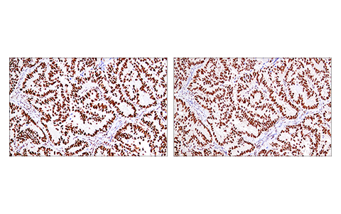 Immunohistochemistry Image 6: 53BP1 (E7N5D) Rabbit Monoclonal Antibody