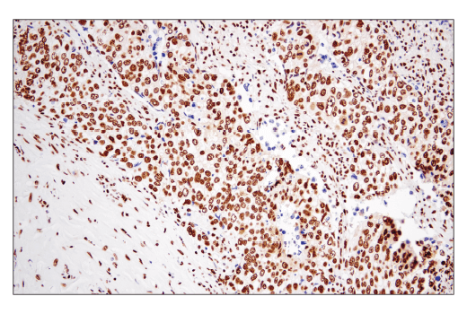 Immunohistochemistry Image 3: PTBP1 (E5O2S) Rabbit Monoclonal Antibody