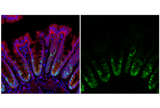 Immunofluorescence Image 1: CDK2 (E8J9T) Rabbit Monoclonal Antibody
