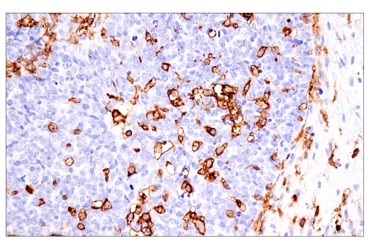 Immunohistochemistry Image 1: FcR gamma (E6Y1A) Rabbit Monoclonal Antibody (BSA and Azide Free)