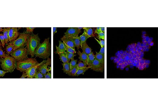Immunofluorescence Image 1: MARCKS (D88D11) Rabbit Monoclonal Antibody (BSA and Azide Free)