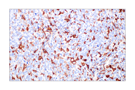 Immunohistochemistry Image 3: CD206/MRC1 (E6T5J) Rabbit Monoclonal Antibody
