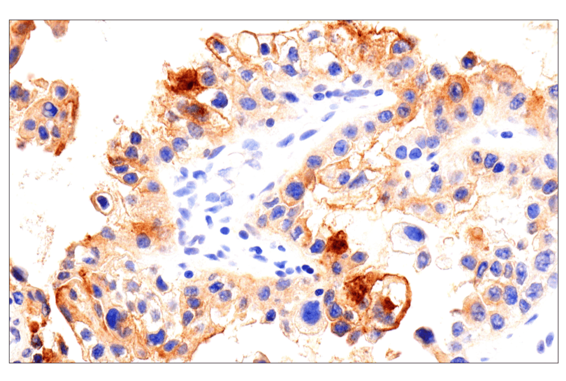 Immunohistochemistry Image 5: Folate Receptor Alpha/FOLR1 (BN3.2) Mouse Monoclonal Antibody