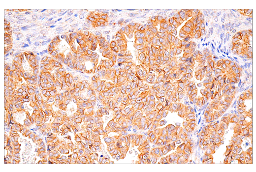 Immunohistochemistry Image 3: HER2/ErbB2 (CB11) Mouse Monoclonal Antibody