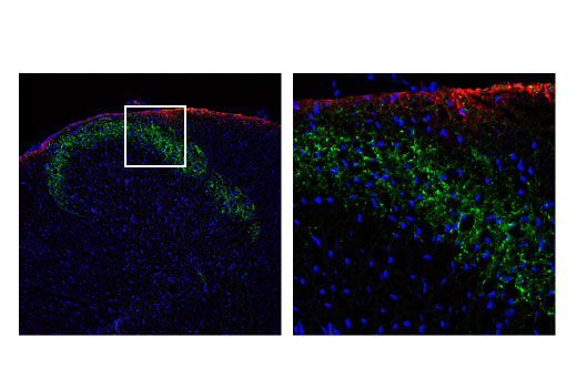 Immunofluorescence Image 1: CGRP (D5R8F) Rabbit Monoclonal Antibody