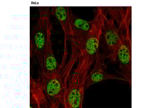 Immunofluorescence Image 1: CBP (D6C5) Rabbit Monoclonal Antibody (BSA and Azide Free)