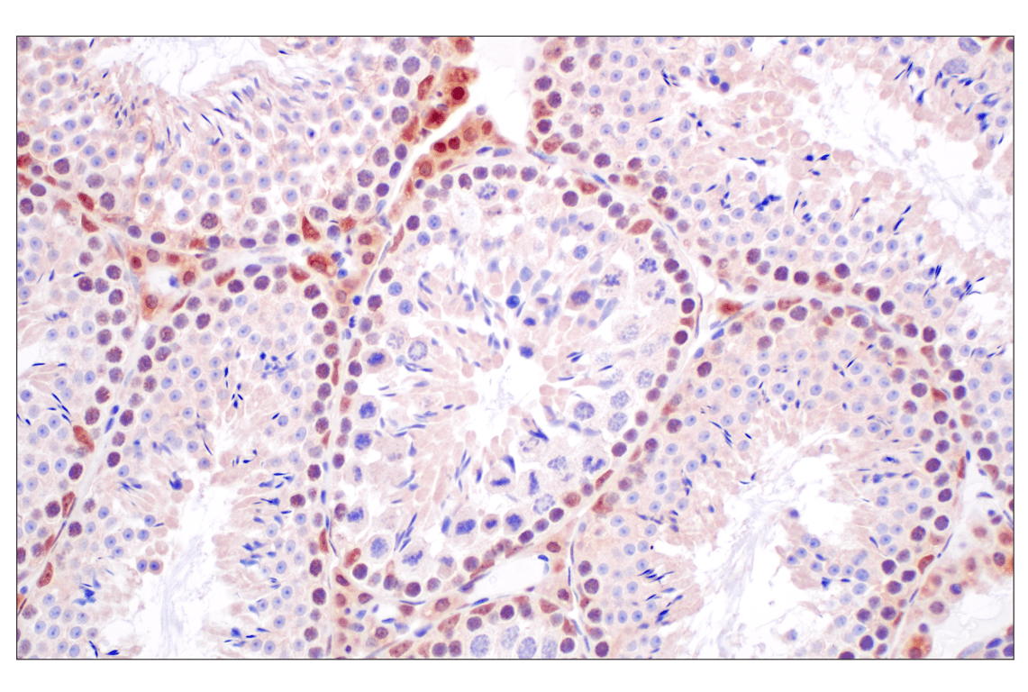 Immunohistochemistry Image 14: FKBP5 (F1G3I) Rabbit Monoclonal Antibody