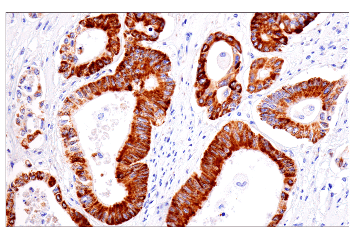 Immunohistochemistry Image 1: AMACR (F7T6V) Rabbit Monoclonal Antibody