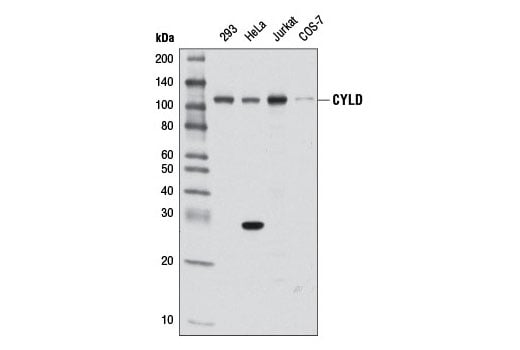 Western Blotting Image 1: CYLD (D1A10) Rabbit mAb