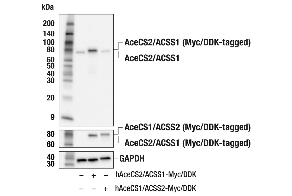 Western Blotting Image 2: AceCS2/ACSS1 (E6T5E) Rabbit Monoclonal Antibody
