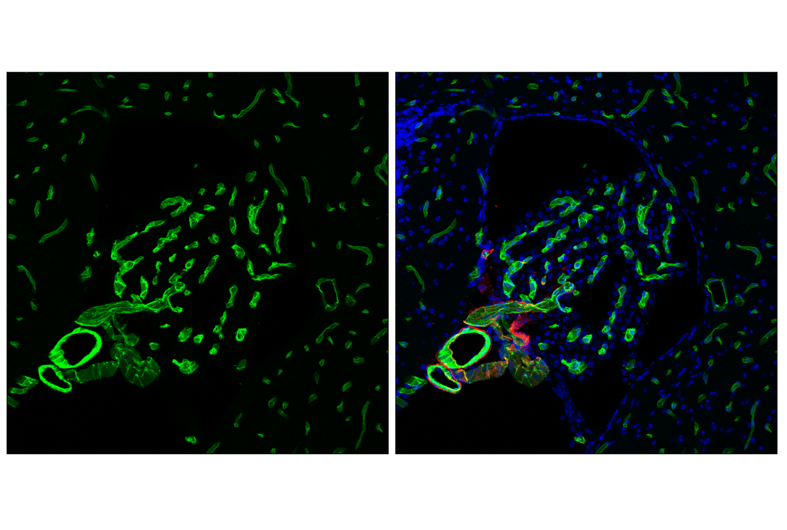 Immunofluorescence Image 3: CD31 (PECAM-1) (F2N3M) Rabbit Monoclonal Antibody