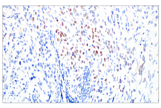 Immunohistochemistry Image 2: Phospho-Histone H2A.X (Ser139) (20E3) Rabbit Monoclonal Antibody (BSA and Azide Free)
