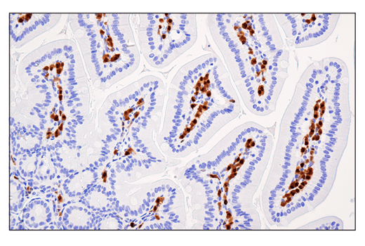 Immunohistochemistry Image 5: IRF-4 (E8H3S) XP<sup>®</sup> Rabbit mAb