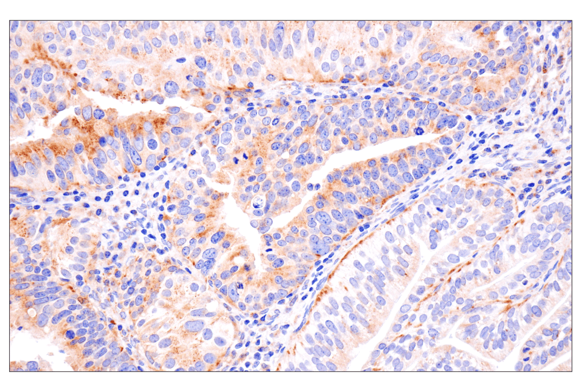 Immunohistochemistry Image 3: Presenilin 2 (F7E5Q) Rabbit Monoclonal Antibody