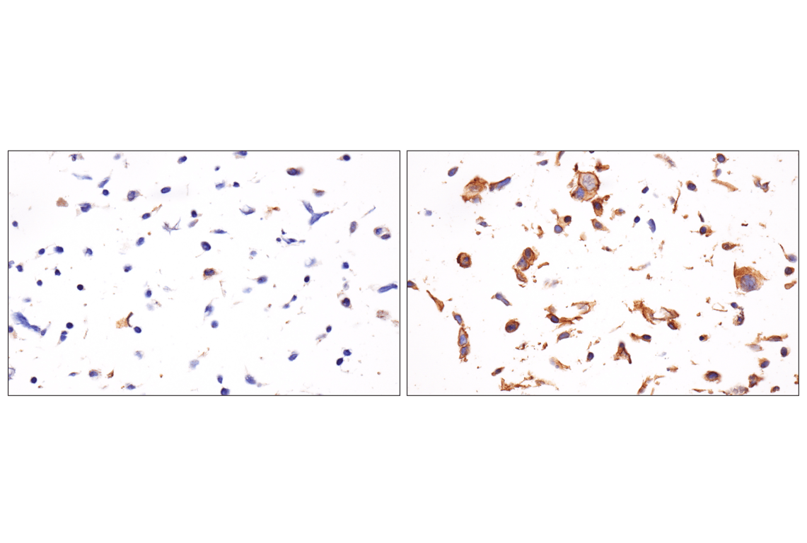 Immunohistochemistry Image 7: PD-L1 (F3Z1T) Rabbit Monoclonal Antibody (BSA and Azide Free)