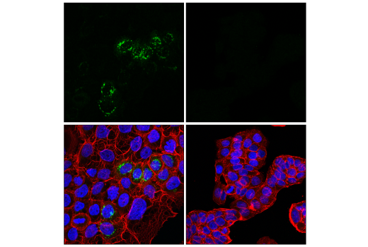 Immunofluorescence Image 1: MMP-1 (E9S9N) Rabbit Monoclonal Antibody