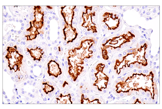 undefined Image 32: SARS-CoV-2 Virus-Host Interaction Antibody Sampler Kit
