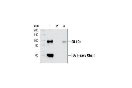 undefined Image 11: Phospho-Insulin/IGF Receptor Antibody Sampler Kit