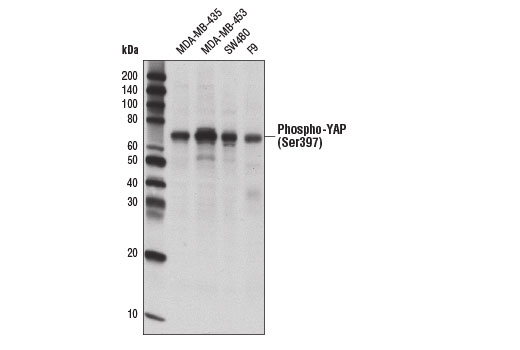 undefined Image 5: PhosphoPlus<sup>®</sup> YAP (Ser397) Antibody Duet