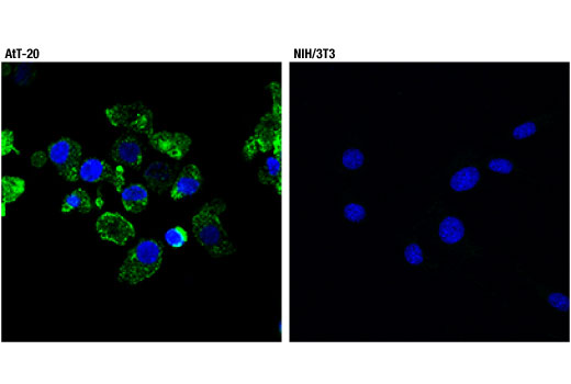 Immunofluorescence Image 1: POMC (D3R1U) Rabbit Monoclonal Antibody