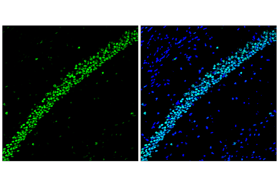 Immunofluorescence Image 2: TCF4/ITF2 (E3X2Y) Rabbit Monoclonal Antibody