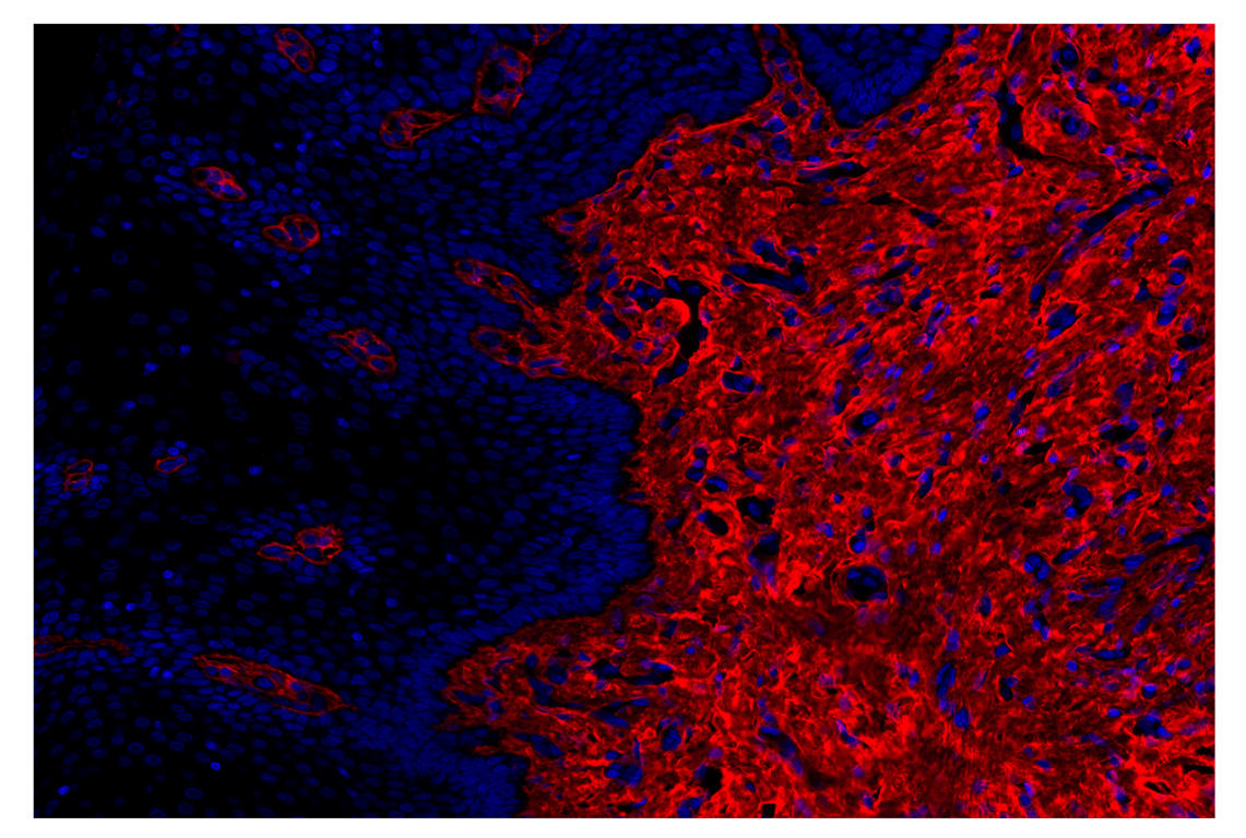 Immunohistochemistry Image 2: COL1A1 (E8F4L) Rabbit Monoclonal Antibody (Alexa Fluor<sup>®</sup> 555 Conjugate)