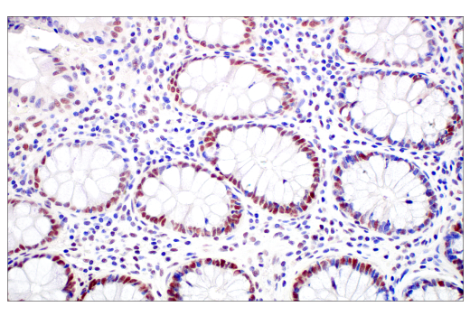 Immunohistochemistry Image 4: MLH1 (ES05) Mouse Monoclonal Antibody