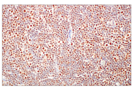Immunohistochemistry Image 5: Rad50 (E4J5R) Rabbit Monoclonal Antibody