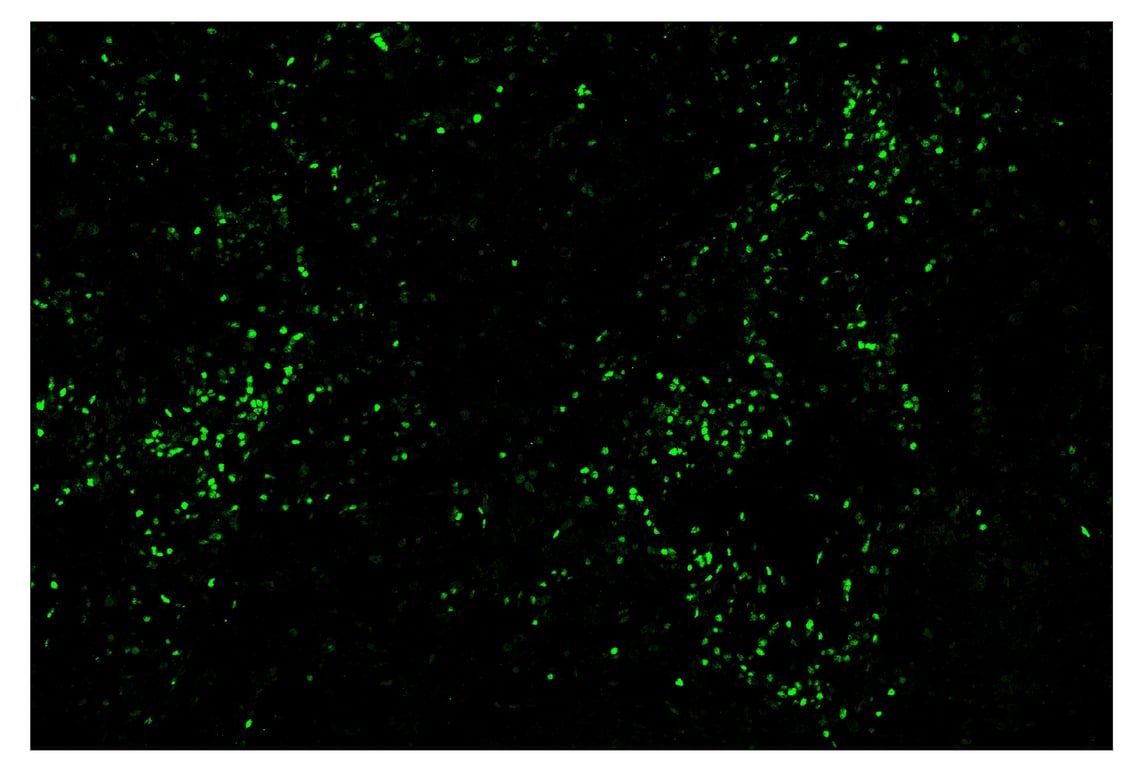 Immunohistochemistry Image 2: TCF1/TCF7 (C63D9) & CO-0006-594 SignalStar<sup>™</sup> Oligo-Antibody Pair