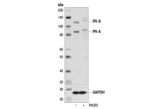 Western Blotting Image 2: Progesterone Receptor A/B (D8Q2J) Rabbit Monoclonal Antibody (BSA and Azide Free)
