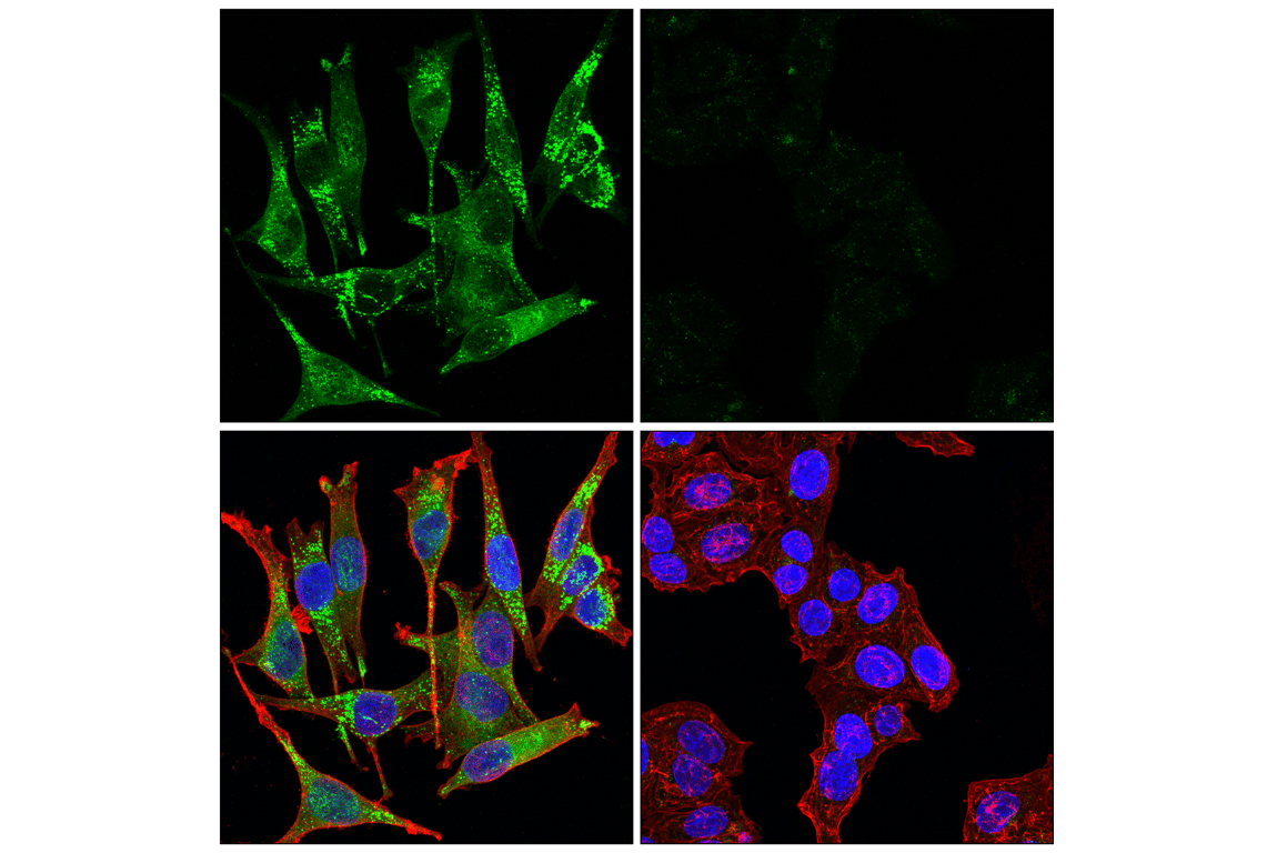 Immunofluorescence Image 1: ACSL3 (E2S9L) Rabbit Monoclonal Antibody