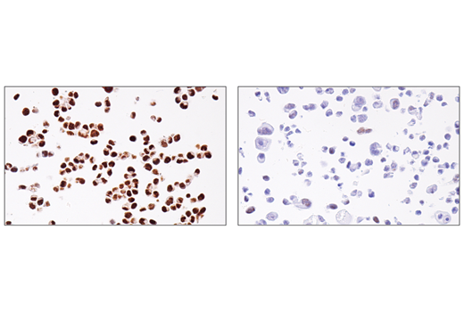Immunohistochemistry Image 5: ADAR1 (E6X9R) Rabbit Monoclonal Antibody (BSA and Azide Free)