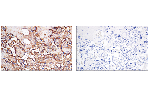 Immunohistochemistry Image 6: CD141/Thrombomodulin (E7Y9P) Rabbit Monoclonal Antibody
